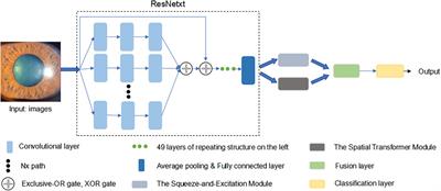 Detection of Fuchs’ Uveitis Syndrome From Slit-Lamp Images Using Deep Convolutional Neural Networks in a Chinese Population